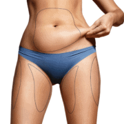 Warum Bauchfett gefährlich ist Fett am Bauch loswerden